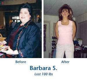 Barbara S. before and after
