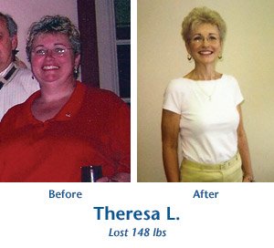 Theresa L. before and after picture